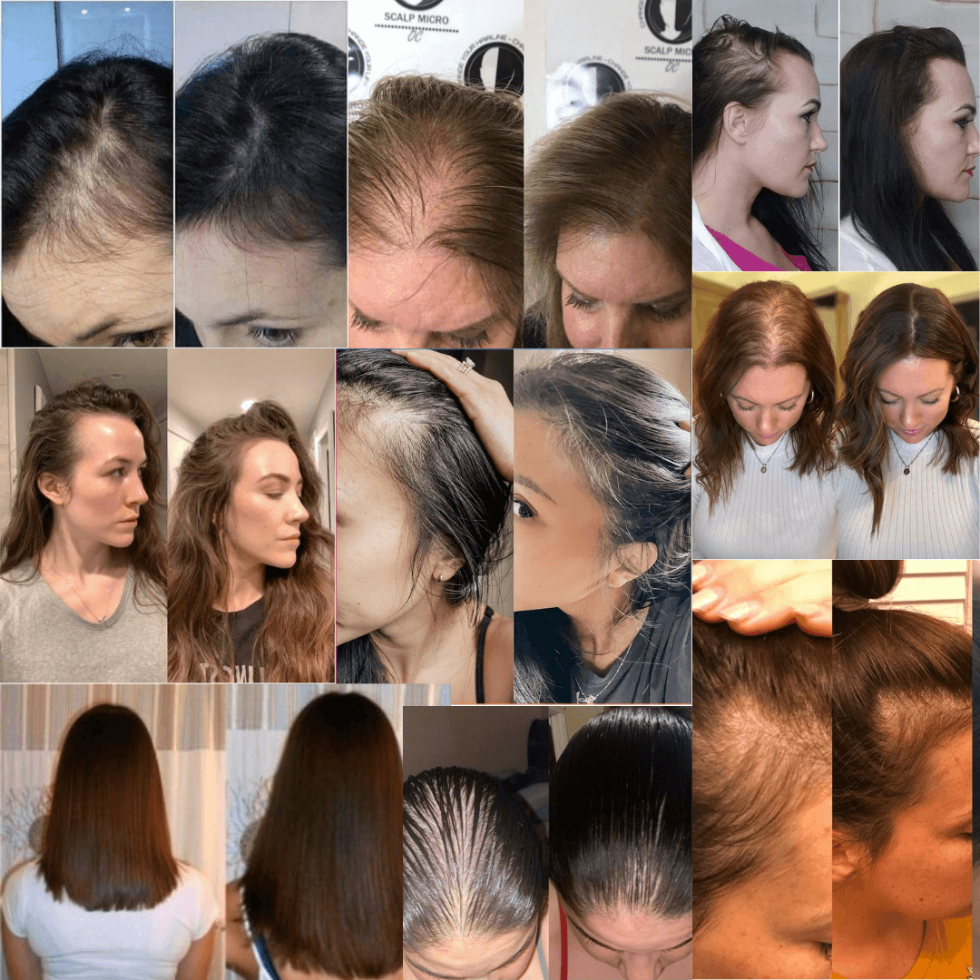 LumiHair – 3-in-1 Red Light Therapy + Free Rosemary Oil - ElyGlam